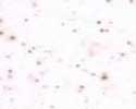 Frost Granite